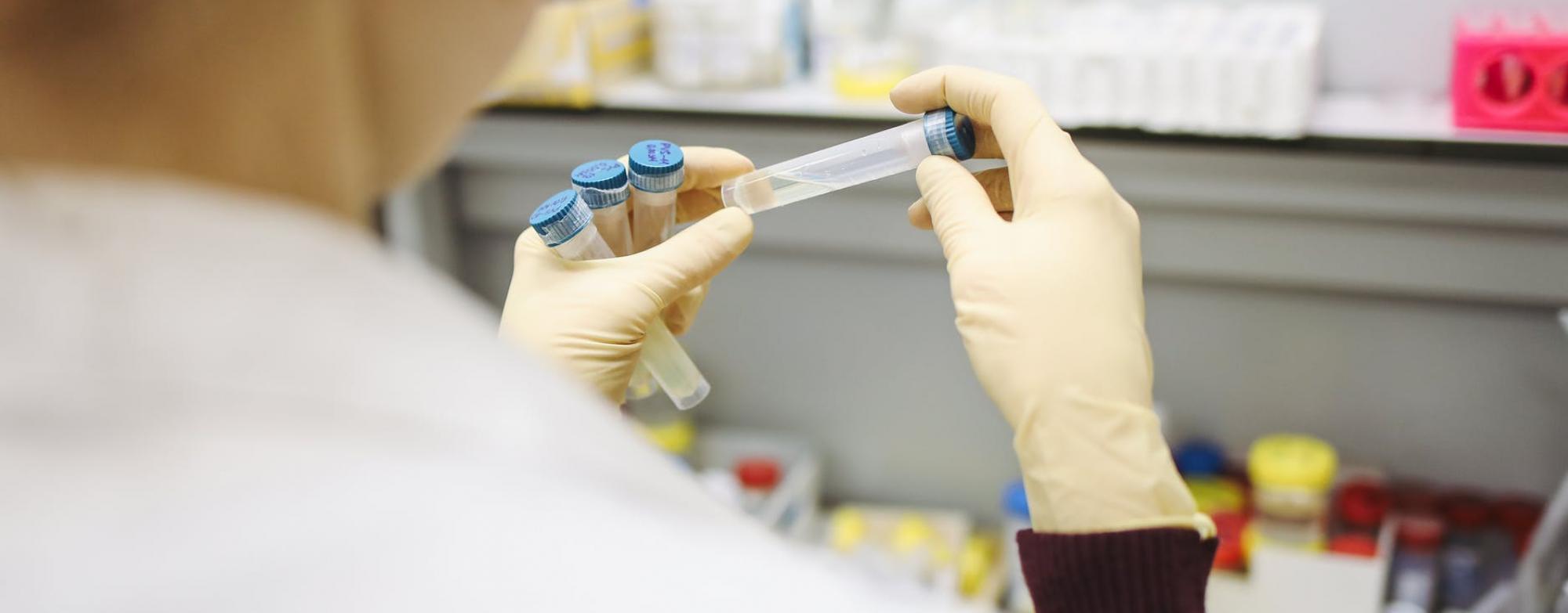 lab test