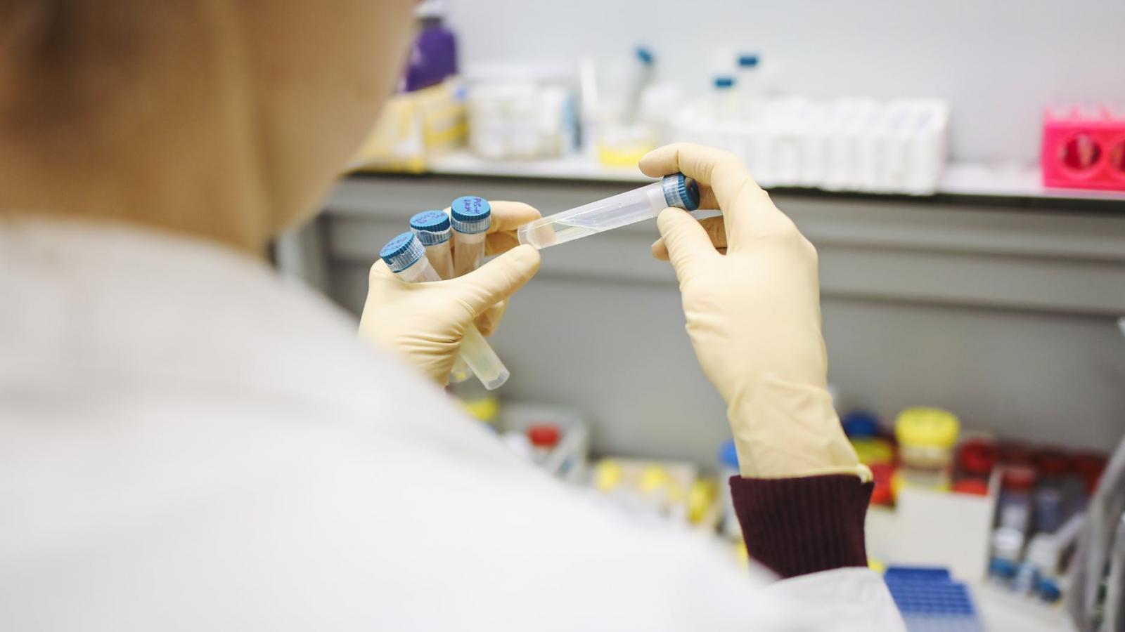 lab test