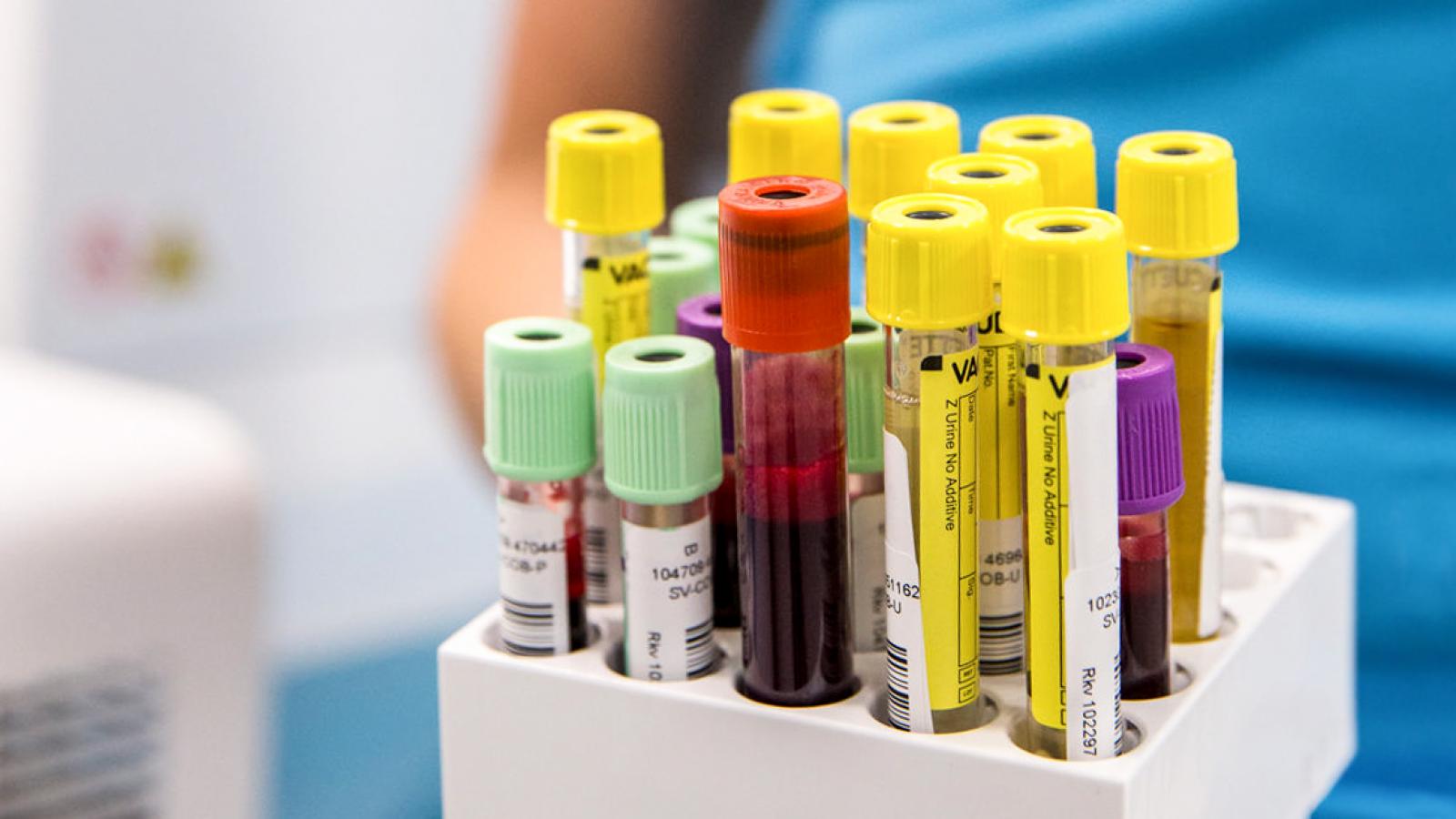 Blood vials standing upright in a tray